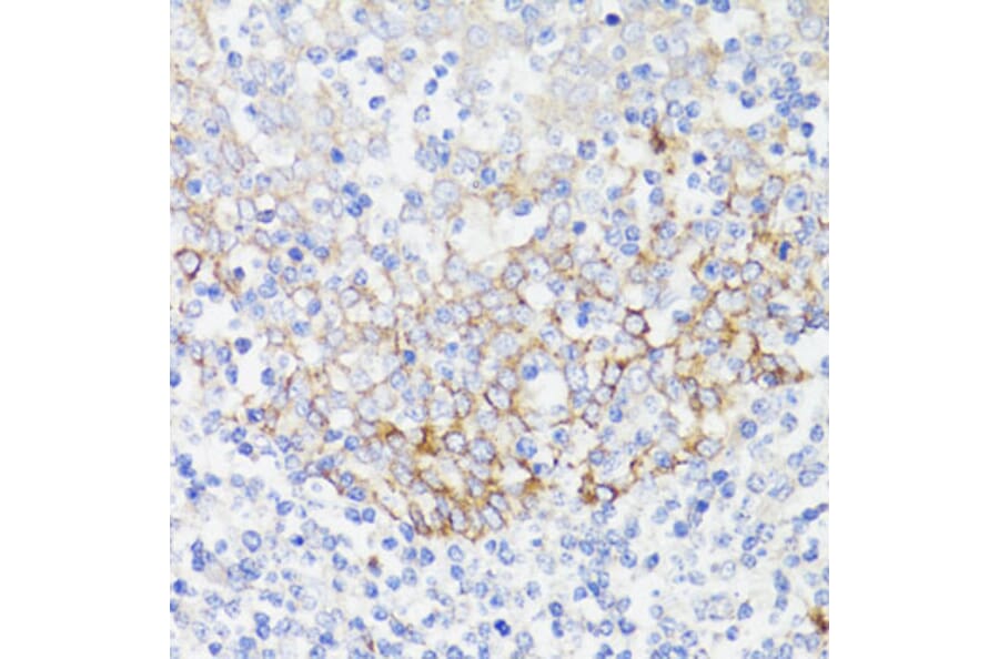 Immunohistochemistry - Anti-EGFR Antibody (A81037) - Antibodies.com