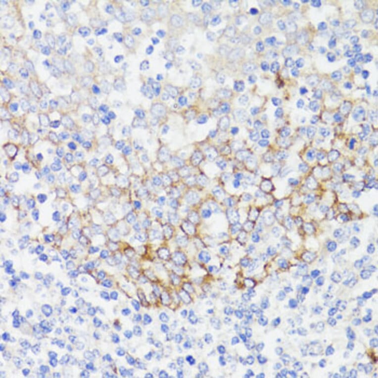 Immunohistochemistry - Anti-EGFR Antibody (A81037) - Antibodies.com