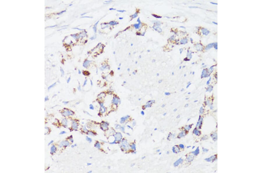 Immunohistochemistry - Anti-EGFR Antibody (A81037) - Antibodies.com