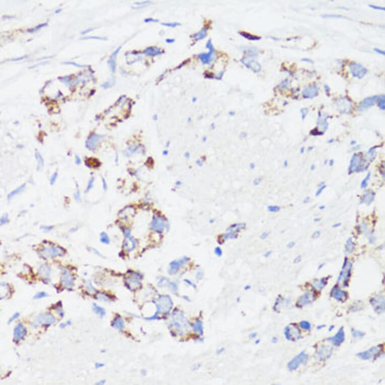 Immunohistochemistry - Anti-EGFR Antibody (A81037) - Antibodies.com