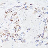 Immunohistochemistry - Anti-EGFR Antibody (A81037) - Antibodies.com
