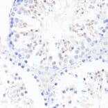 Immunohistochemistry - Anti-EGFR Antibody (A81037) - Antibodies.com