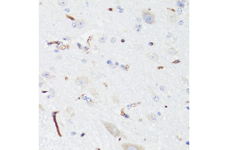 Immunohistochemistry - Anti-EGFR Antibody (A81037) - Antibodies.com