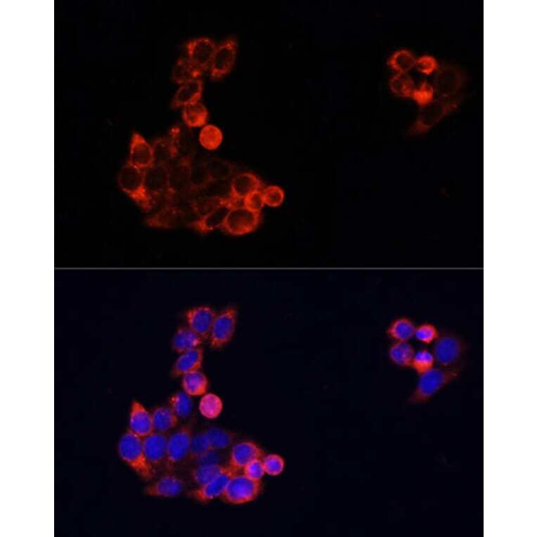 Immunofluorescence - Anti-EGFR Antibody (A81037) - Antibodies.com