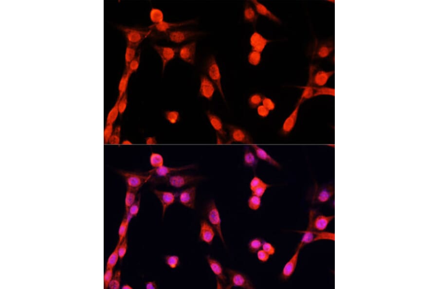 Immunofluorescence - Anti-EGFR Antibody (A81037) - Antibodies.com