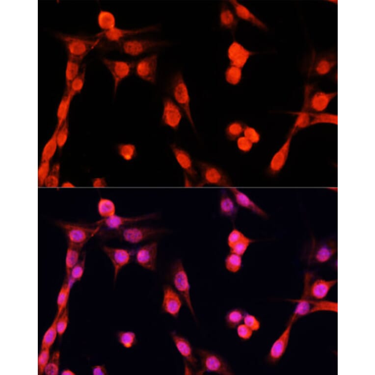Immunofluorescence - Anti-EGFR Antibody (A81037) - Antibodies.com