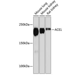 Western Blot - Anti-Angiotensin Converting Enzyme 1 Antibody [ARC0577] (A81038) - Antibodies.com