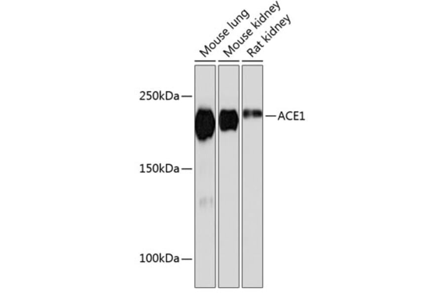 Western Blot - Anti-Angiotensin Converting Enzyme 1 Antibody [ARC0577] (A81038) - Antibodies.com