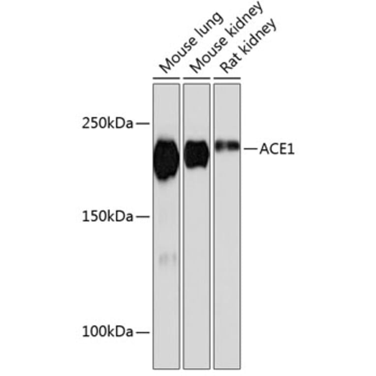 Western Blot - Anti-Angiotensin Converting Enzyme 1 Antibody [ARC0577] (A81038) - Antibodies.com