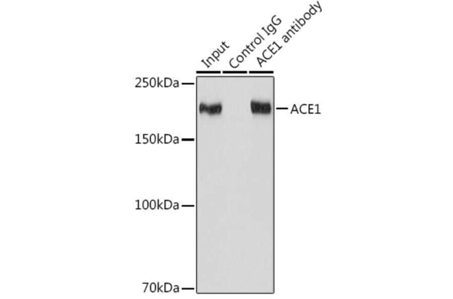 Western Blot - Anti-Angiotensin Converting Enzyme 1 Antibody [ARC0577] (A81038) - Antibodies.com