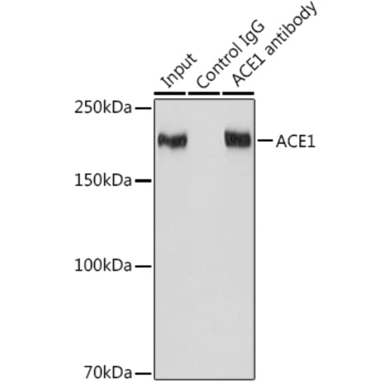 Western Blot - Anti-Angiotensin Converting Enzyme 1 Antibody [ARC0577] (A81038) - Antibodies.com