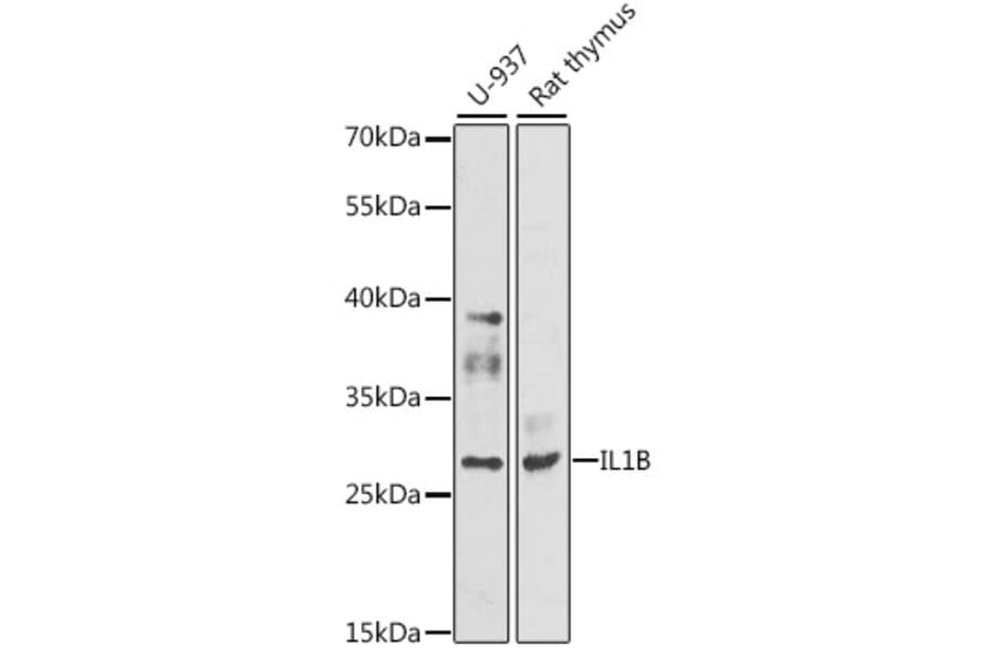 Western Blot - Anti-IL1B Antibody (A11369) - Antibodies.com