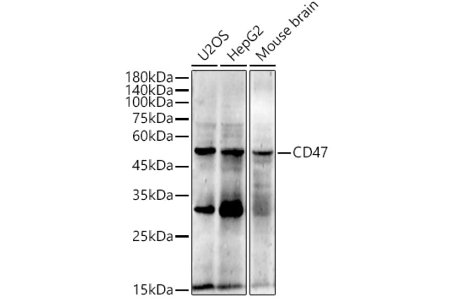 Western Blot - Anti-CD47 Antibody [ARC0584] (A81040) - Antibodies.com