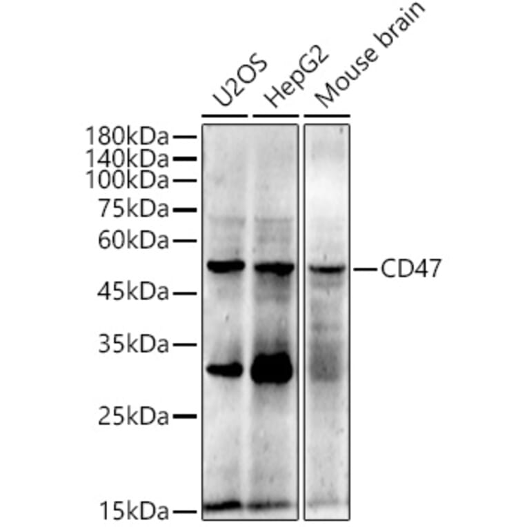 Western Blot - Anti-CD47 Antibody [ARC0584] (A81040) - Antibodies.com