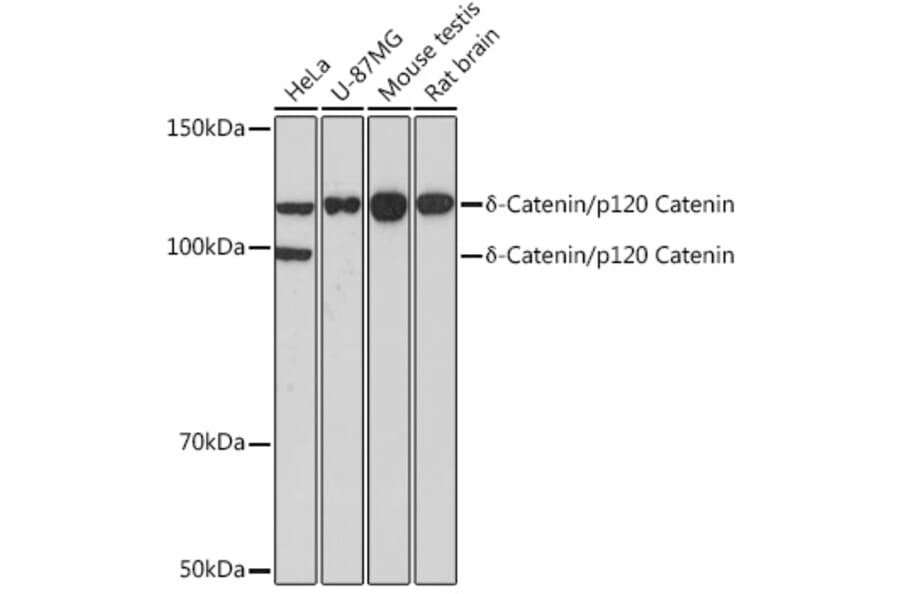 Western Blot - Anti-delta 1 Catenin/CAS Antibody (A81041) - Antibodies.com