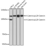 Western Blot - Anti-delta 1 Catenin/CAS Antibody (A81041) - Antibodies.com