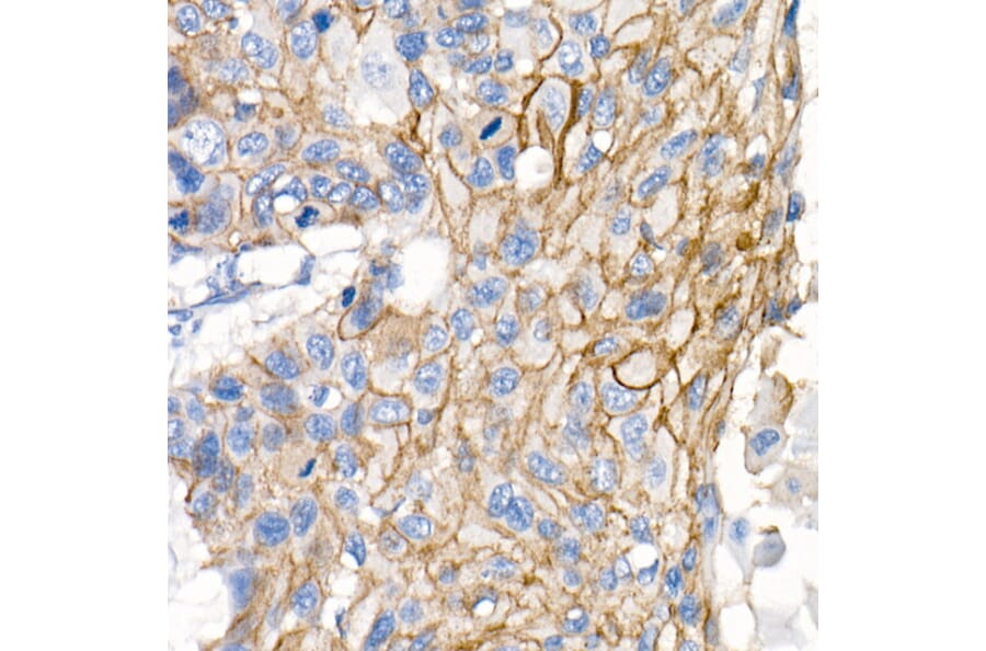 Immunohistochemistry - Anti-delta 1 Catenin/CAS Antibody (A81041) - Antibodies.com