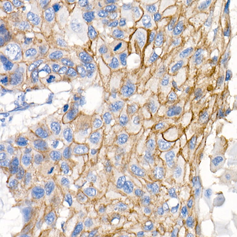 Immunohistochemistry - Anti-delta 1 Catenin/CAS Antibody (A81041) - Antibodies.com
