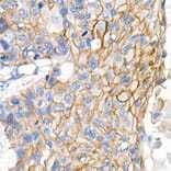 Immunohistochemistry - Anti-delta 1 Catenin/CAS Antibody (A81041) - Antibodies.com