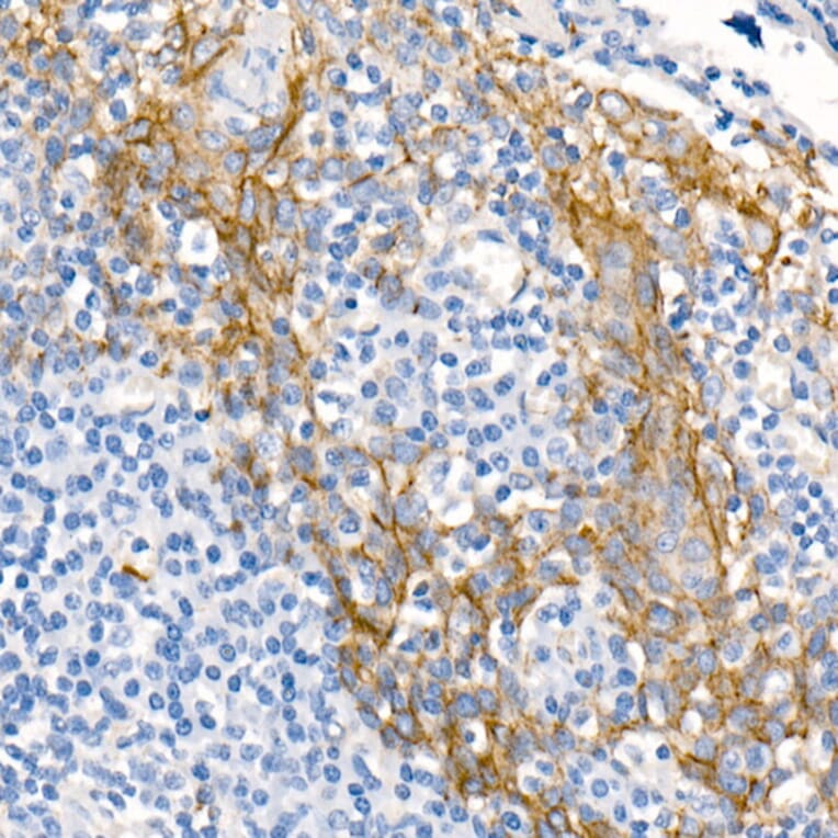 Immunohistochemistry - Anti-delta 1 Catenin/CAS Antibody (A81041) - Antibodies.com
