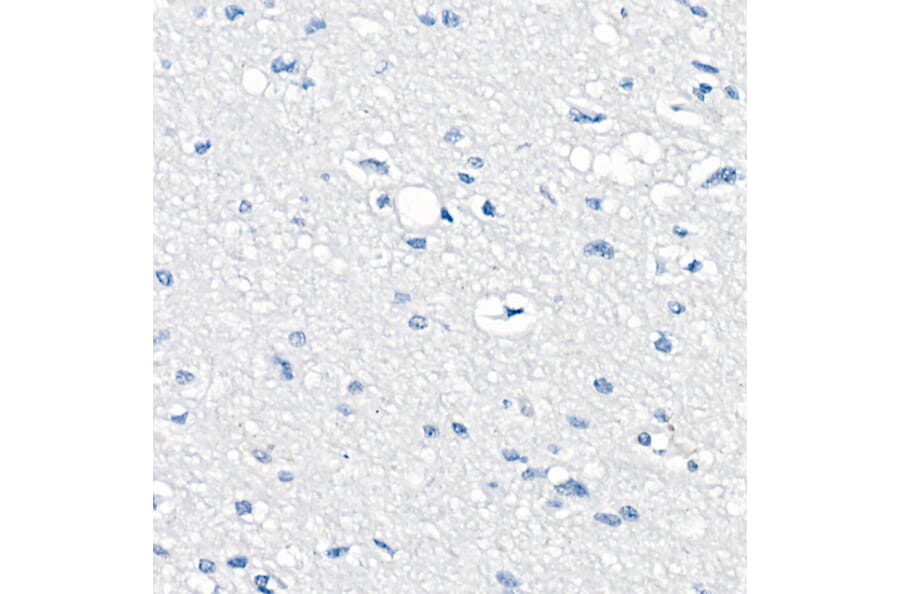 Immunohistochemistry - Anti-delta 1 Catenin/CAS Antibody (A81041) - Antibodies.com