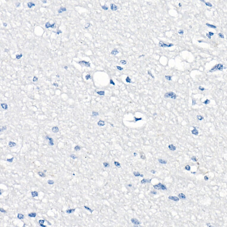 Immunohistochemistry - Anti-delta 1 Catenin/CAS Antibody (A81041) - Antibodies.com