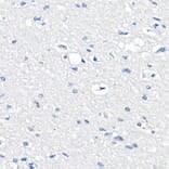 Immunohistochemistry - Anti-delta 1 Catenin/CAS Antibody (A81041) - Antibodies.com