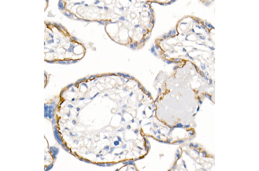 Immunohistochemistry - Anti-delta 1 Catenin/CAS Antibody (A81041) - Antibodies.com