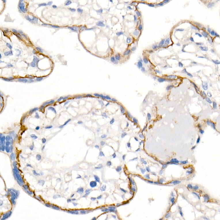 Immunohistochemistry - Anti-delta 1 Catenin/CAS Antibody (A81041) - Antibodies.com