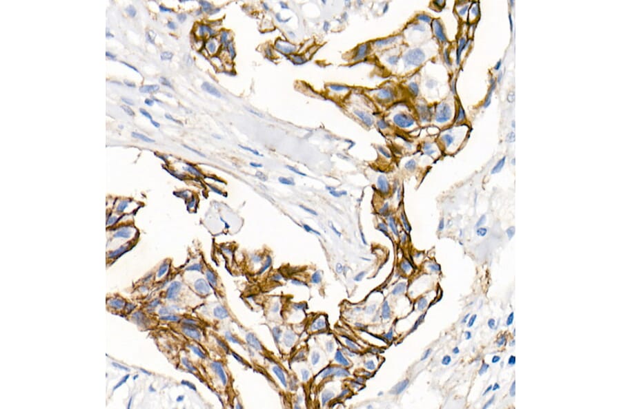 Immunohistochemistry - Anti-delta 1 Catenin/CAS Antibody (A81041) - Antibodies.com