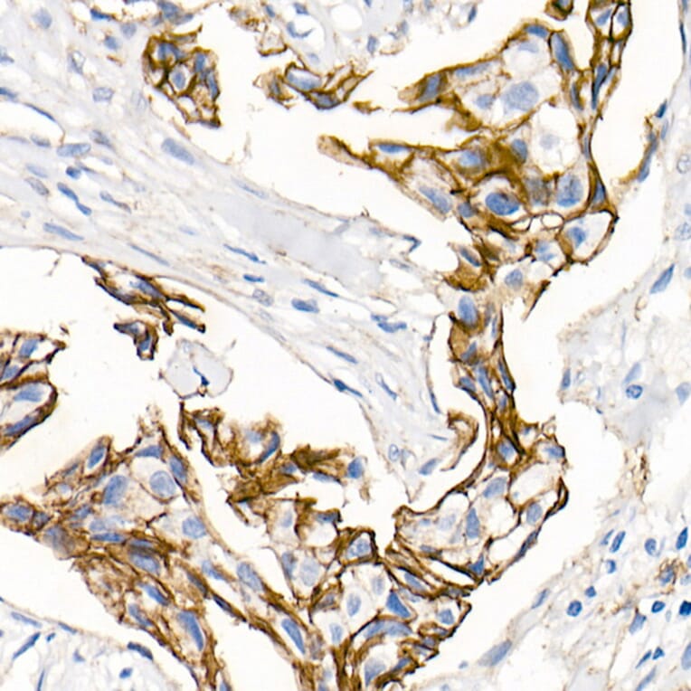 Immunohistochemistry - Anti-delta 1 Catenin/CAS Antibody (A81041) - Antibodies.com