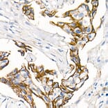 Immunohistochemistry - Anti-delta 1 Catenin/CAS Antibody (A81041) - Antibodies.com