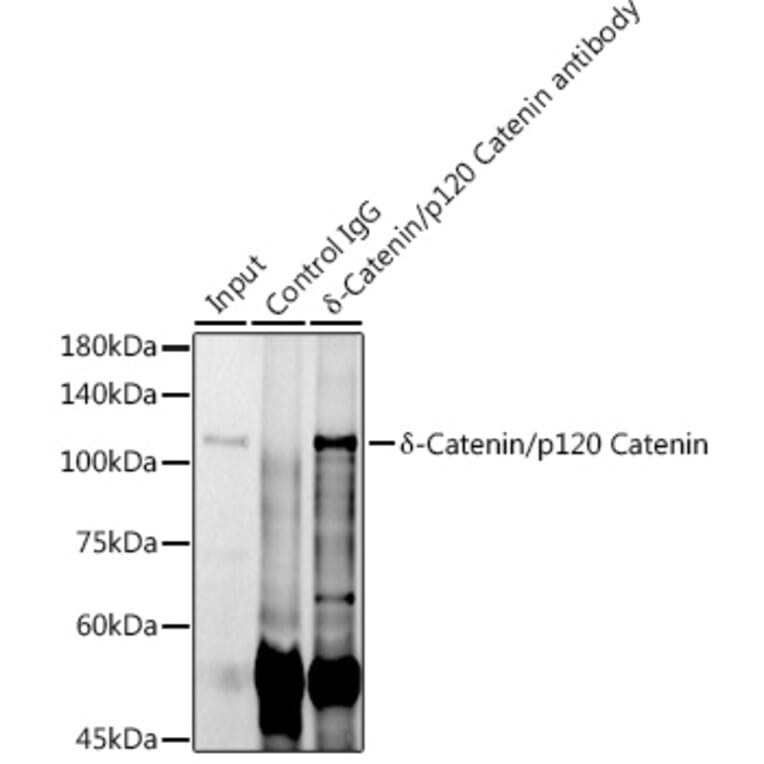 Western Blot - Anti-delta 1 Catenin/CAS Antibody (A81041) - Antibodies.com