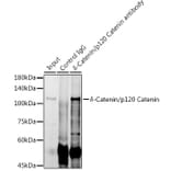 Western Blot - Anti-delta 1 Catenin/CAS Antibody (A81041) - Antibodies.com