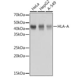 Western Blot - Anti-HLA-A Antibody [ARC0588] (A81042) - Antibodies.com