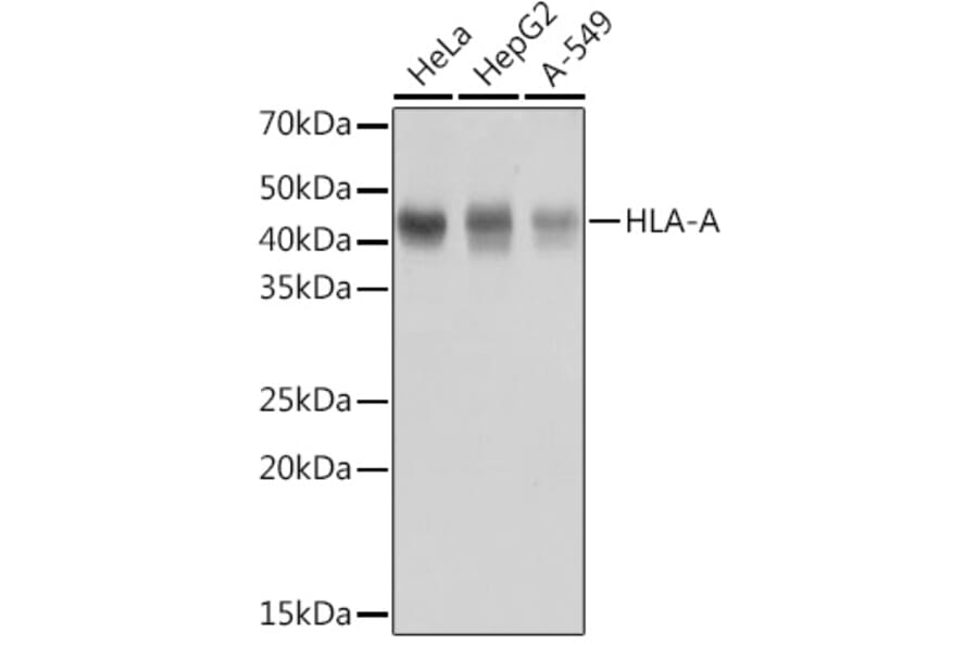 Western Blot - Anti-HLA-A Antibody [ARC0588] (A81042) - Antibodies.com