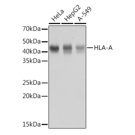 Western Blot - Anti-HLA-A Antibody [ARC0588] (A81042) - Antibodies.com