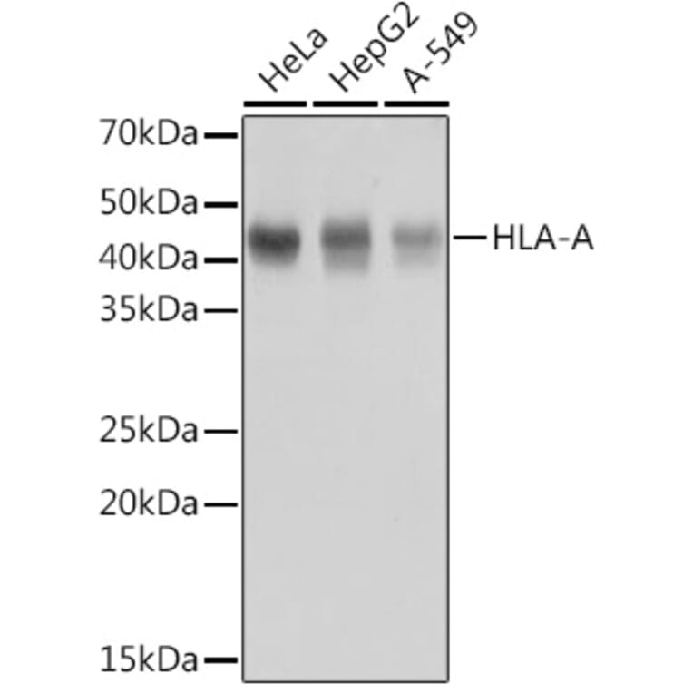Western Blot - Anti-HLA-A Antibody [ARC0588] (A81042) - Antibodies.com