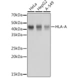 Western Blot - Anti-HLA-A Antibody [ARC0588] (A81042) - Antibodies.com