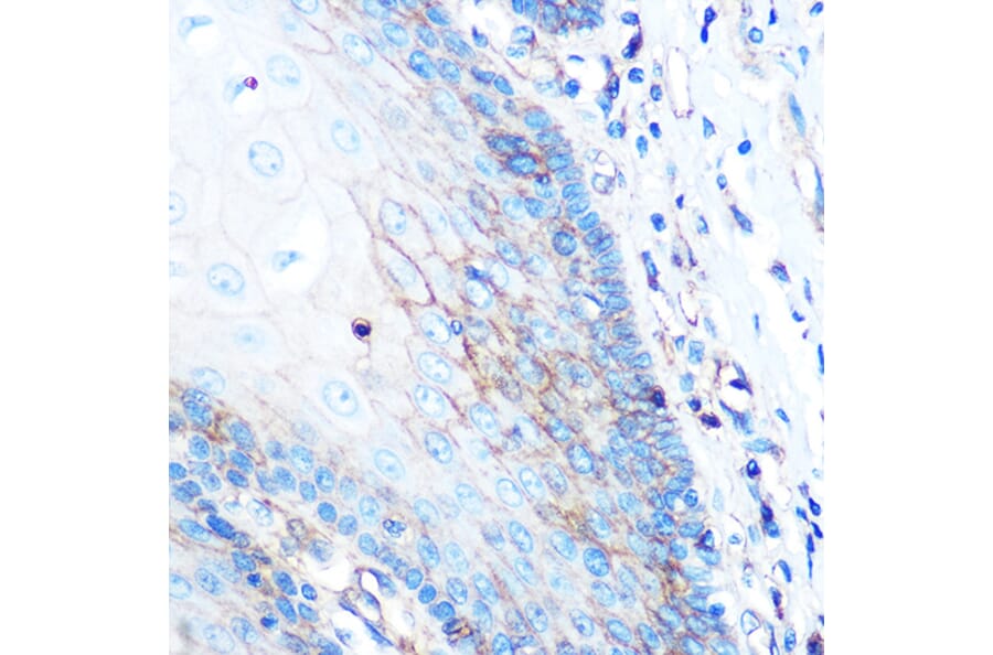 Immunohistochemistry - Anti-HLA-A Antibody [ARC0588] (A81042) - Antibodies.com