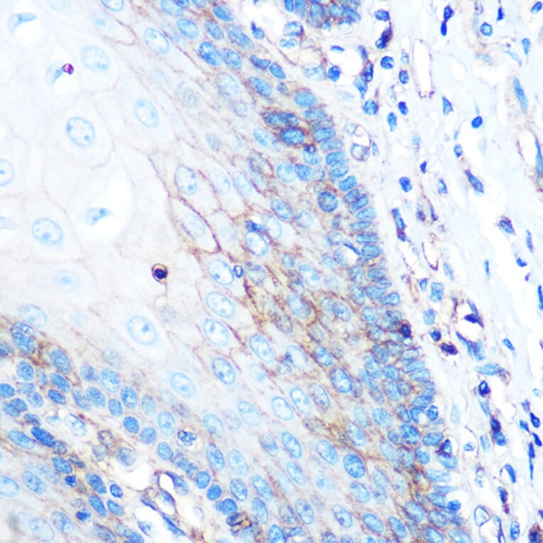 Immunohistochemistry - Anti-HLA-A Antibody [ARC0588] (A81042) - Antibodies.com