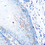 Immunohistochemistry - Anti-HLA-A Antibody [ARC0588] (A81042) - Antibodies.com