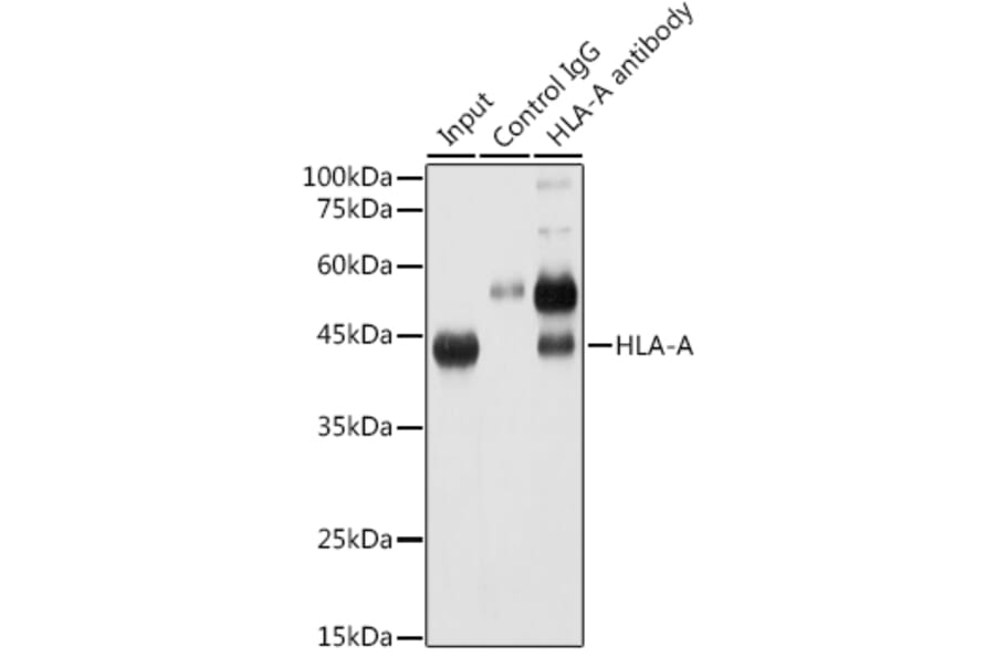 Western Blot - Anti-HLA-A Antibody [ARC0588] (A81042) - Antibodies.com