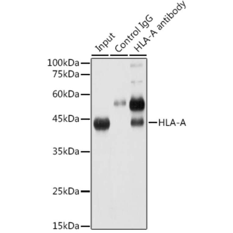 Western Blot - Anti-HLA-A Antibody [ARC0588] (A81042) - Antibodies.com