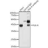 Western Blot - Anti-HLA-A Antibody [ARC0588] (A81042) - Antibodies.com