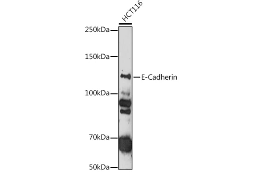Western Blot - Anti-E Cadherin Antibody (A81044) - Antibodies.com