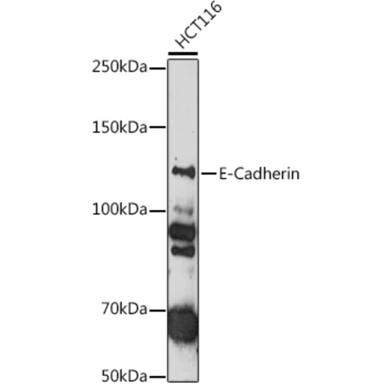 Western Blot - Anti-E Cadherin Antibody (A81044) - Antibodies.com