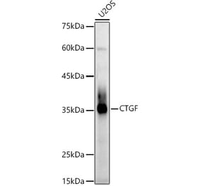 Western Blot - Anti-CTGF Antibody (A81045) - Antibodies.com