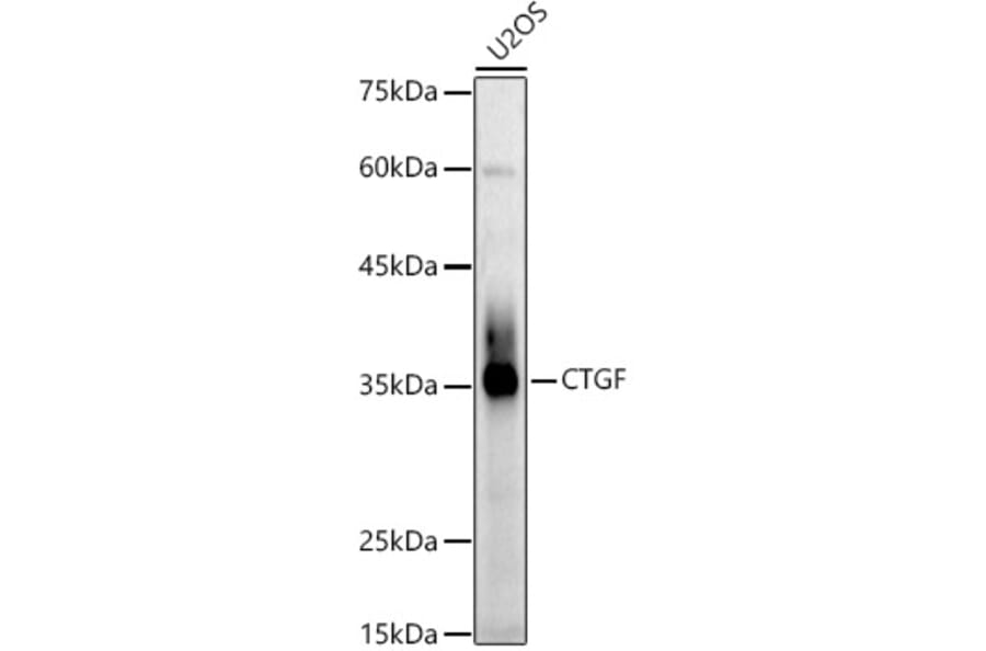 Western Blot - Anti-CTGF Antibody (A81045) - Antibodies.com