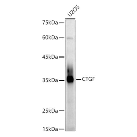 Western Blot - Anti-CTGF Antibody (A81045) - Antibodies.com